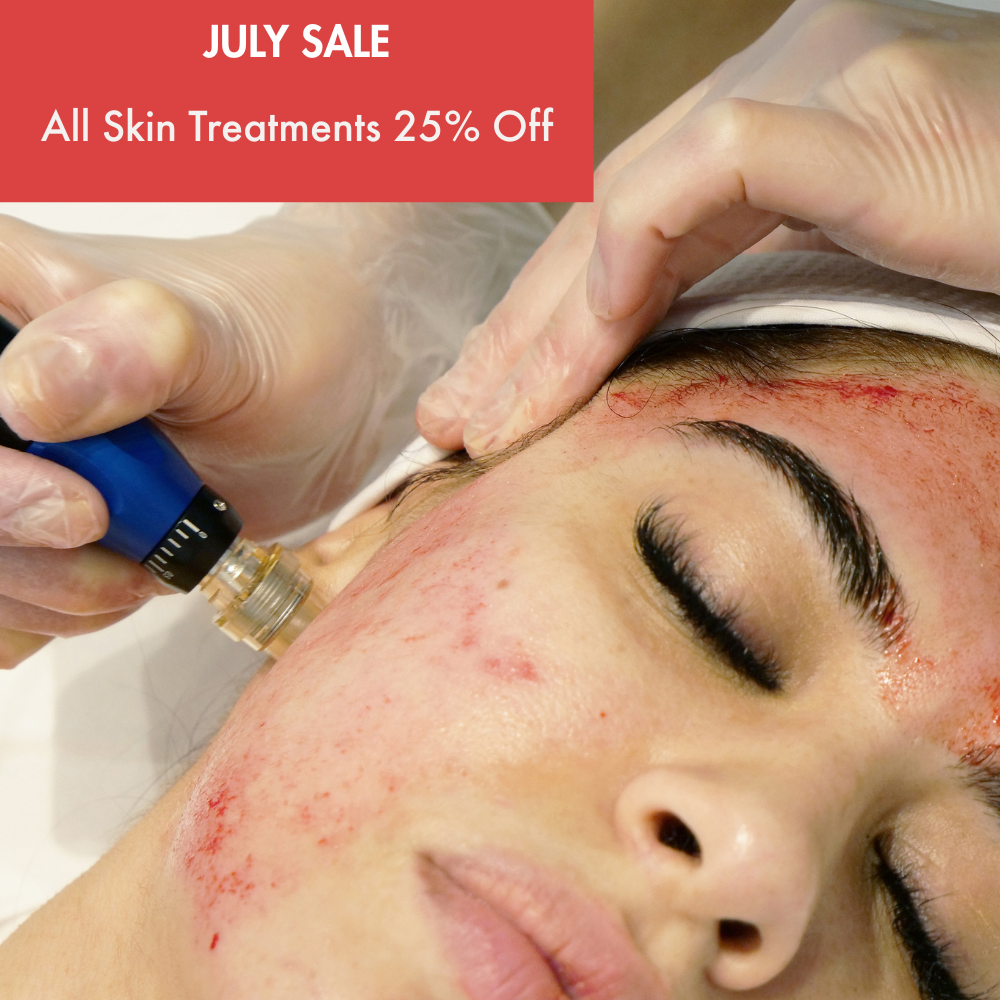 microneedling (3)