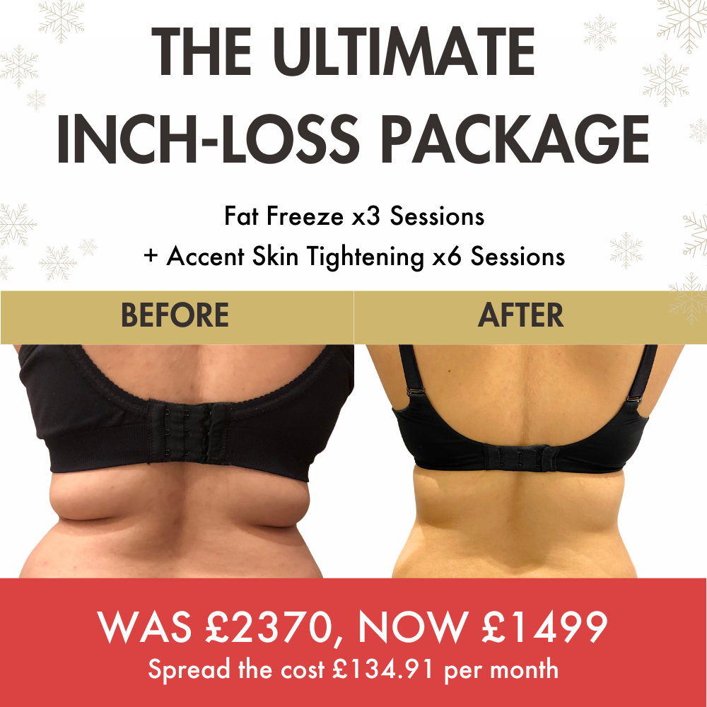 ultimate inch loss package fat freeze and accent (1)-1